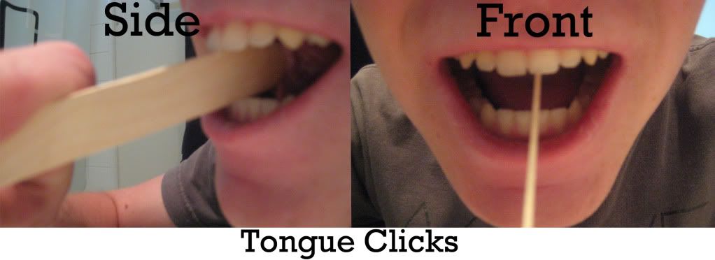 Tongue Thrusting Therapy Exercises