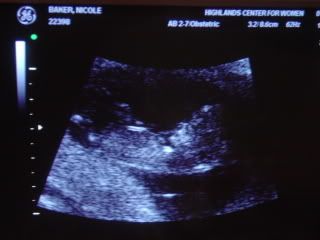3rd Baby Photo