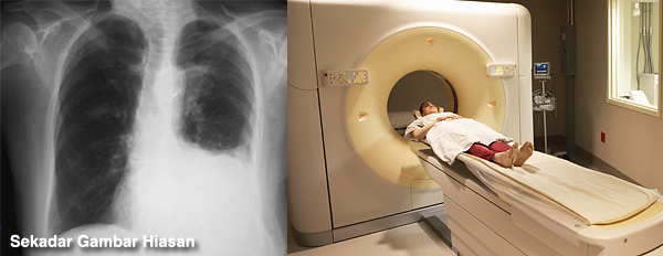 X-ray dan CT Scan