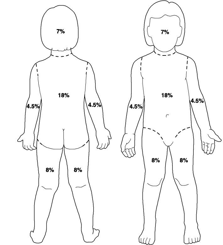 burn chart