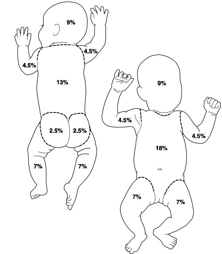 burn chart