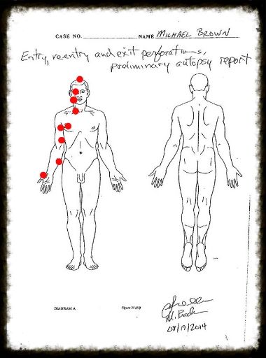 photo michael-brown-autopsy-copy_zps5d8e231c.jpg